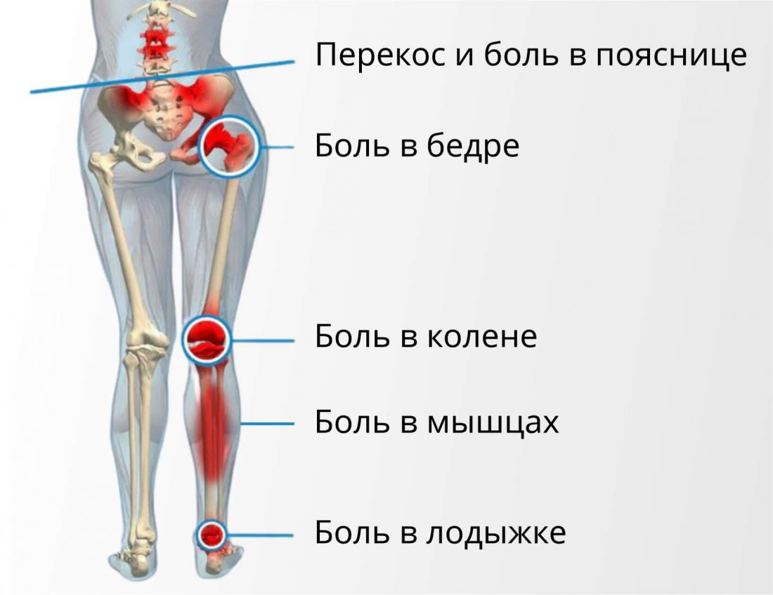 Осложнения