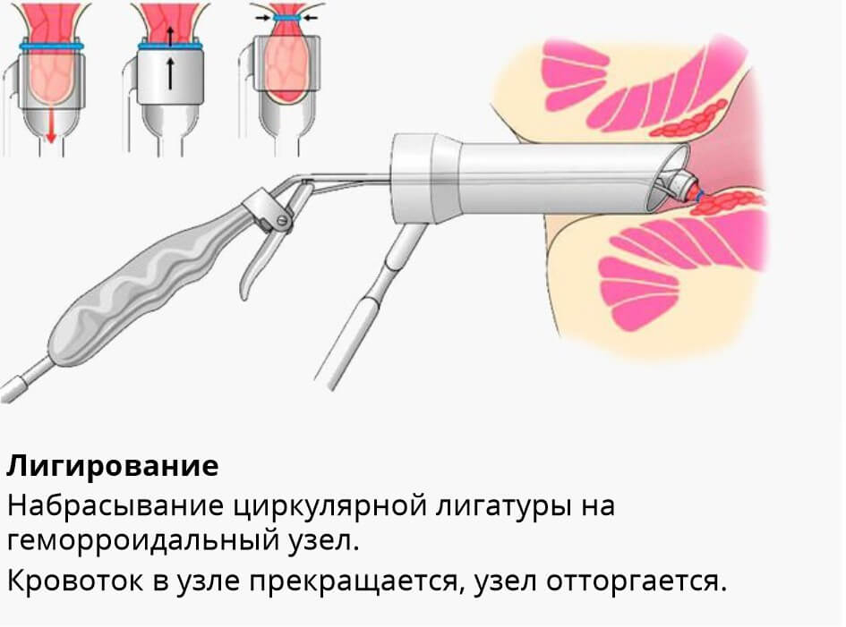 Методы лечения