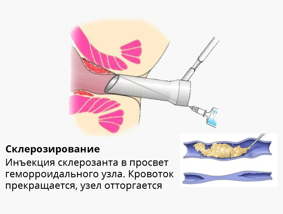 Методы лечения